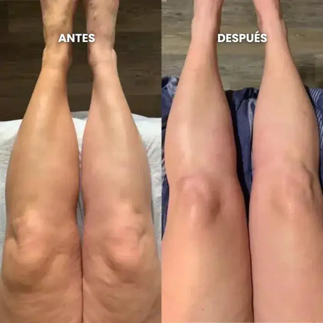 Antes y después: Gemelos