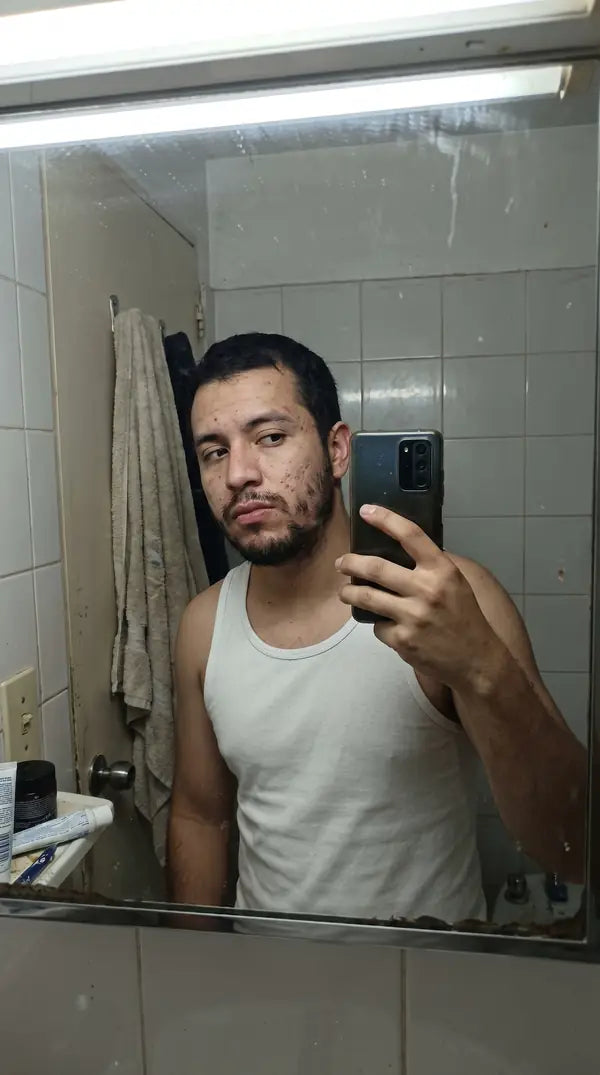 Antes de usar Bálsamo Apolo