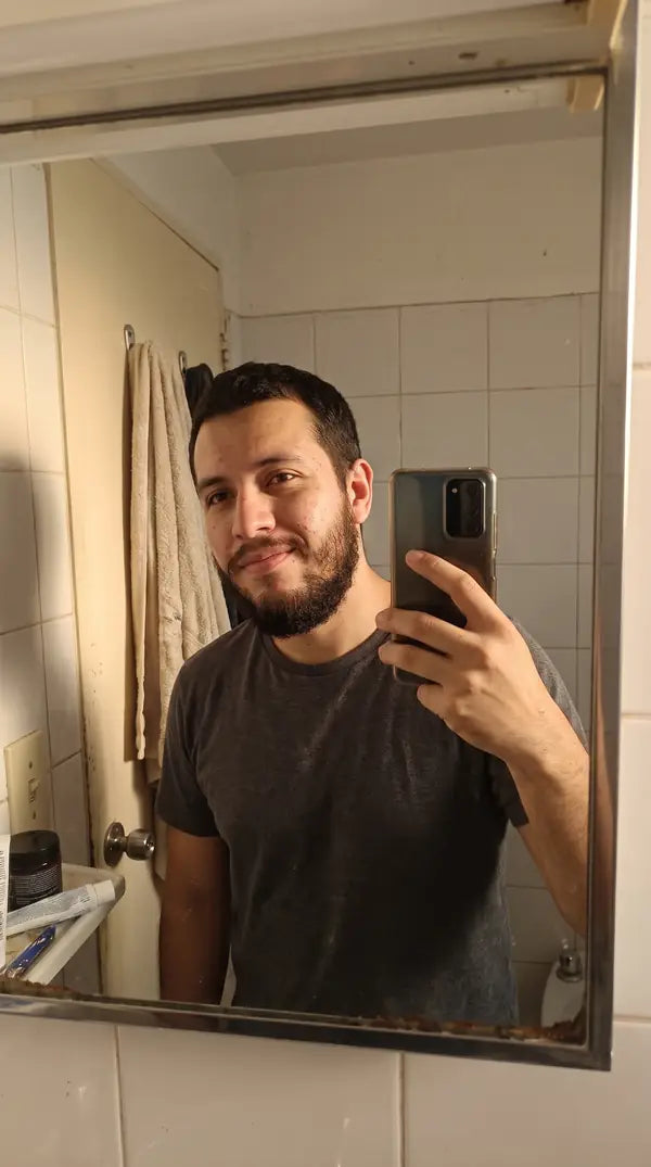 Después de usar Bálsamo Apolo
