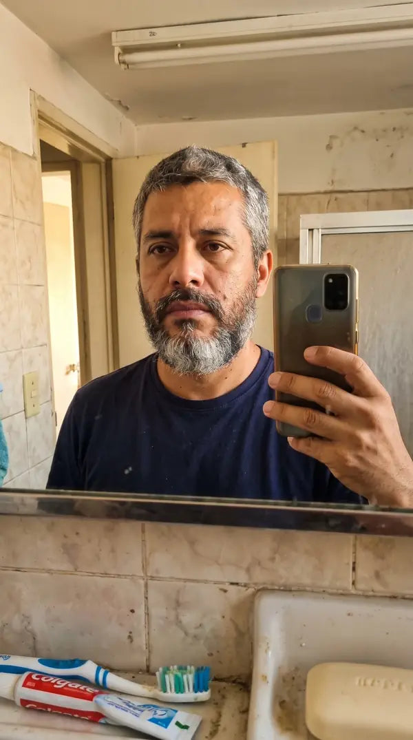 Después de usar Bálsamo Apolo