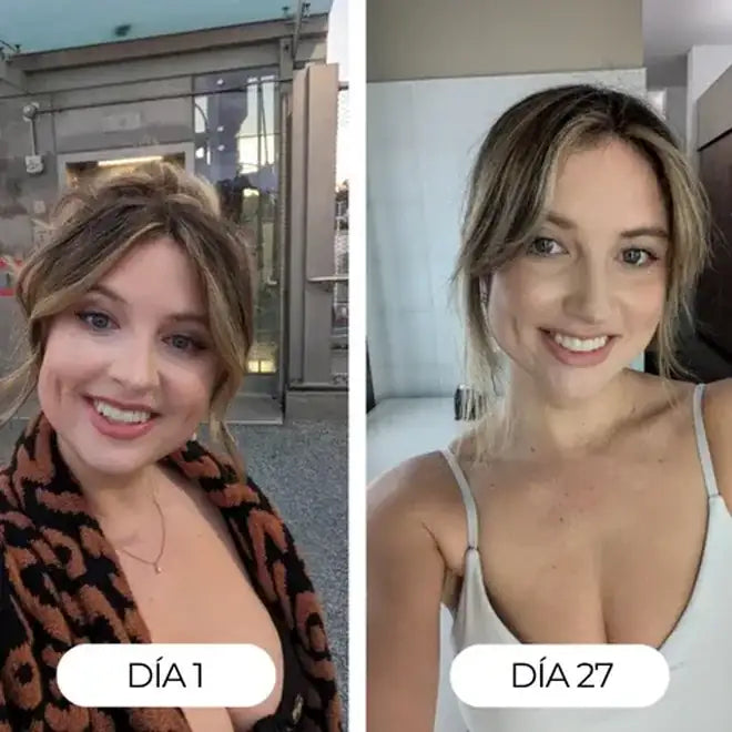 Día 1 y día 27: rostro menos hinchado