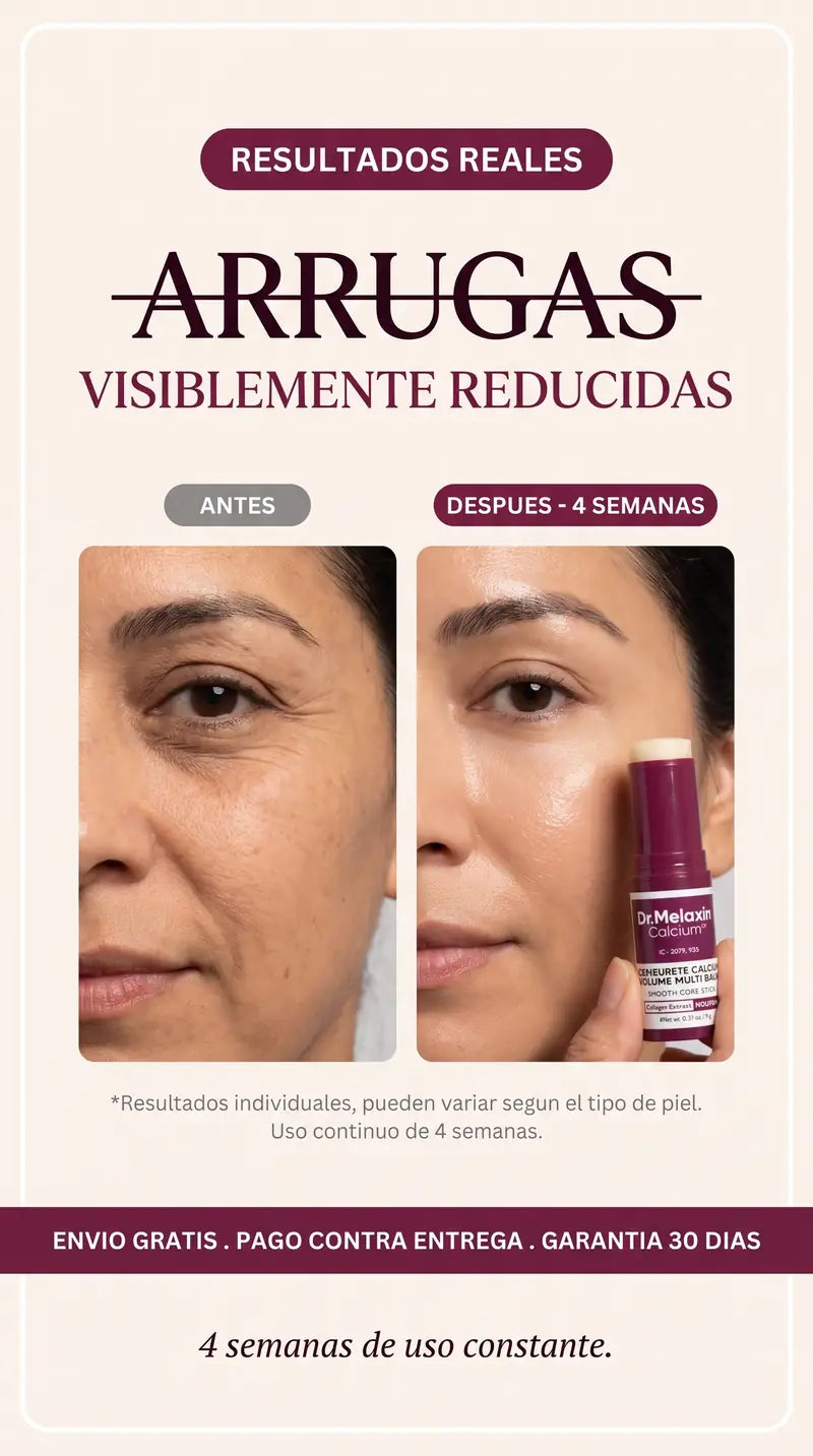 Arrugas visiblemente reducidas en 4 semanas