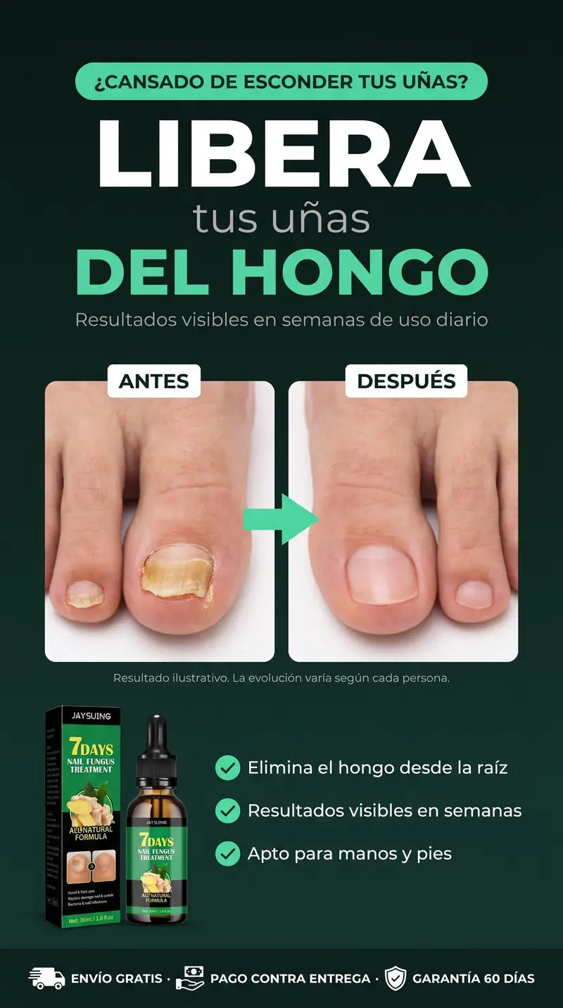 Combate el hongo desde la ra&iacute;z: antes y despu&eacute;s real de la u&ntilde;a